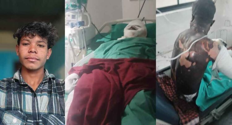 खरसिया औद्योगिक हादसा : 9 माह की मासूम के बाद पिता और युवक की भी मौत