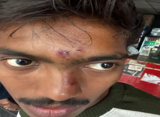 दिनदहाड़े छात्र पर चाकू से हमला, 2 हजार न देने पर वारदात