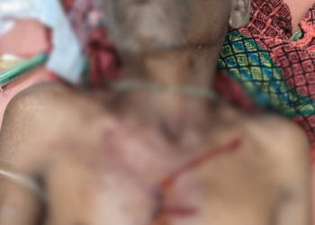 जंगल में महुआ बीनना पड़ा भारी, भालू के हमले में दो ग्रामीण जख्मी