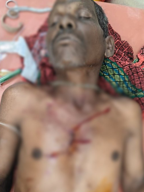 जंगल में महुआ बीनना पड़ा भारी, भालू के हमले में दो ग्रामीण जख्मी