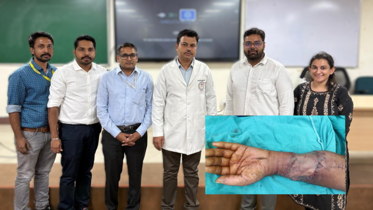 AIIMS रायपुर के डॉक्टरों ने कटा हुआ हाथ सफलतापूर्वक जोड़ा