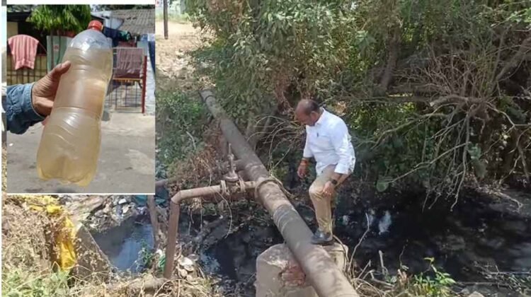 भिलाई सेक्टर-7 में पीलिया का प्रकोप: 35 से ज्यादा बच्चे बीमार, गंदे पानी पर सवाल