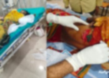 तेंदूपत्ता तोड़ने गई महिलाओं पर जंगली सूअर का हमला, एक की हालत नाजुक