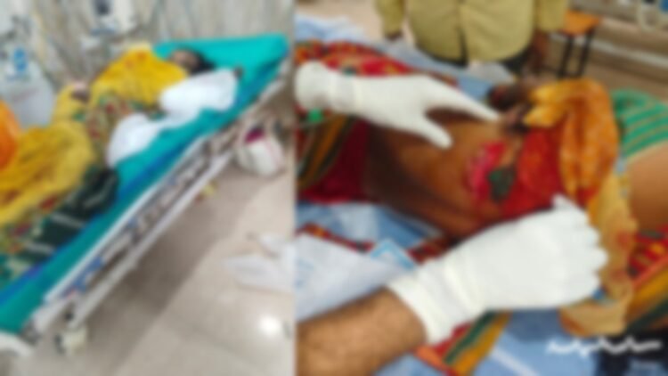 तेंदूपत्ता तोड़ने गई महिलाओं पर जंगली सूअर का हमला, एक की हालत नाजुक