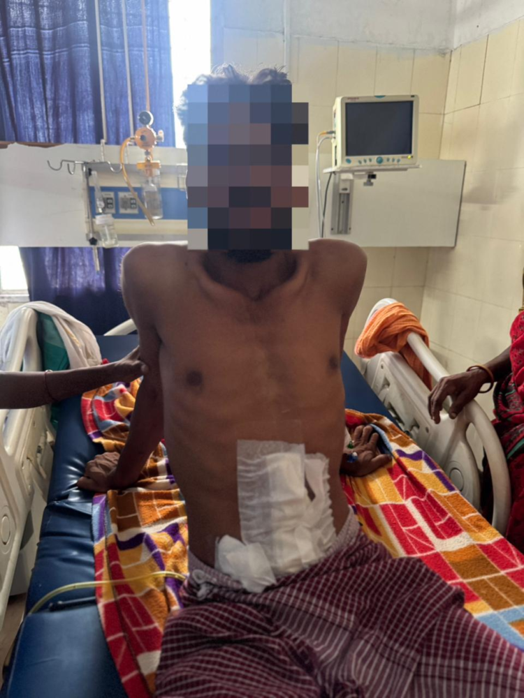 जिला चिकित्सालय बीजापुर में जटिल सर्जरी सफल, गंभीर अवस्था में भर्ती युवक को मिला नया जीवन
