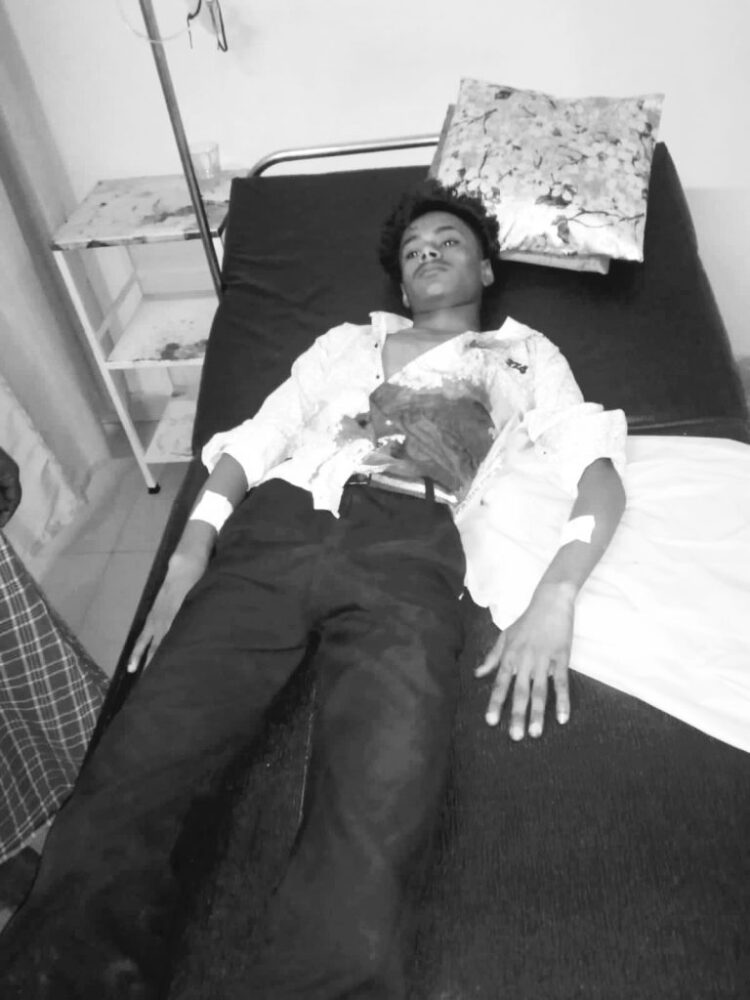 गांजा सप्लायर का पता पूछना पड़ा भारी, इनकार करने पर नाबालिग पर जानलेवा हमला