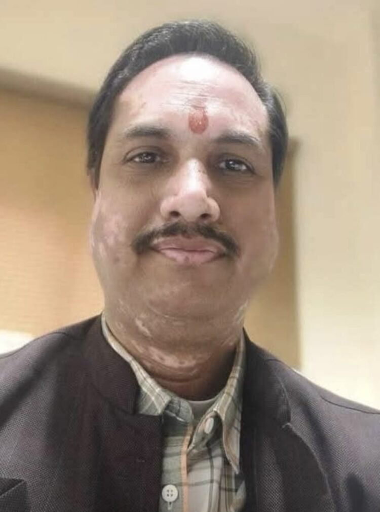 सेवा सेतु : डिजिटल सुशासन की नई पहचान जनता के द्वार- डिजिटल सरकार अब 520 शासकीय सेवाएं घर बैठे एक क्लिक पर- तेजबहादुर सिंह भुवाल