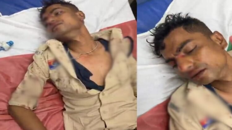 बिलासपुर में डायल-112 के आरक्षक पर हमला, शराबी युवक ने डंडे से फोड़ा सिर