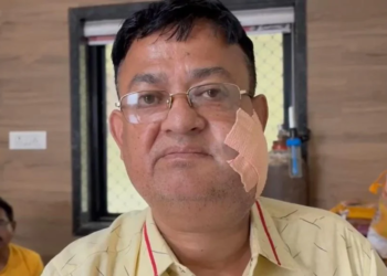दुर्ग में ज्वेलरी कारोबारी पर चाकूबाजी, नाबालिग आरोपी गिरफ्तार; दो साल पुरानी घटना की रंजिश में किया हमला