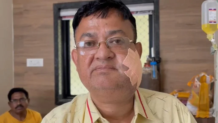 दुर्ग में ज्वेलरी कारोबारी पर चाकूबाजी, नाबालिग आरोपी गिरफ्तार; दो साल पुरानी घटना की रंजिश में किया हमला